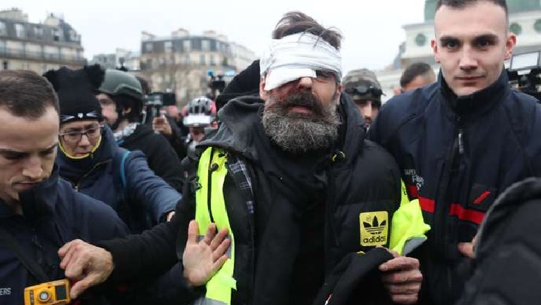 Francë/ Vijon protesta e 'jelekverdhëve', një prej organizatorëve plagoset rëndë në sy