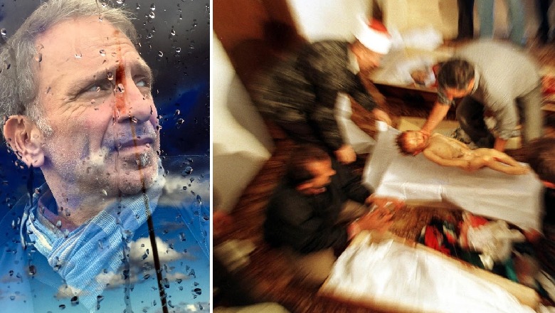 Ndërron jetë fotografi i Reuters që shkrepi  foton ikonë nga lufta e Kosovës