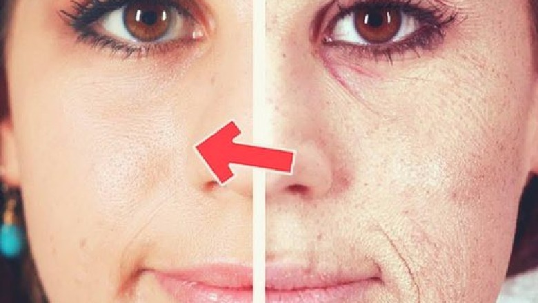 Maska që sfidon dhe Botox-in, si të dukeni 10 vite më e re 