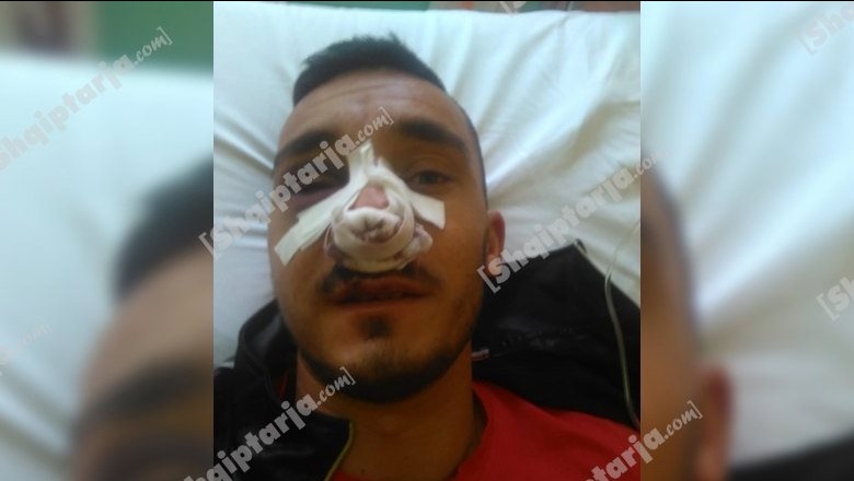 Me hundën e thyer dhe syrin e nxirë/ Ja si miku i Genc Ferhatit me tre shokët dhunuan të dënuarin në burgun e Rrogozhinës (FOTO)