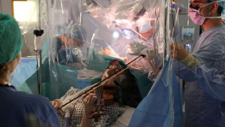 Pacientja i bie violinës gjatë operacionit të heqjes së tumorit në tru (VIDEO)