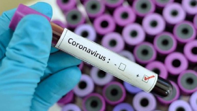 Dy raste të reja me COVID-19, shkon në 90 numri i të infektuar në Kosovë