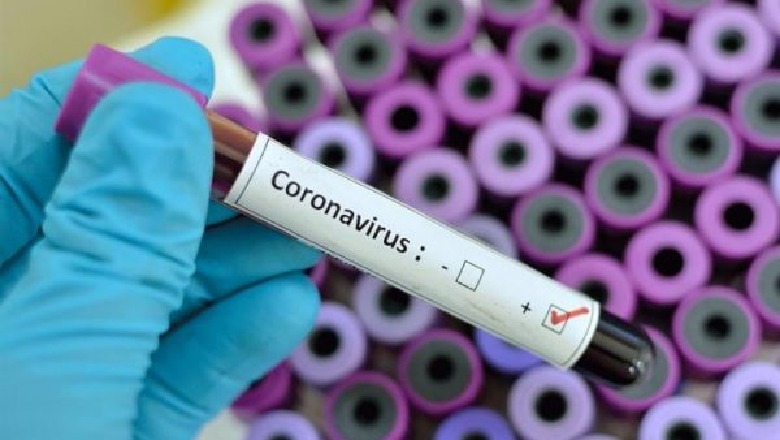 Shënohet viktima e parë me koronavirus në Kosovë, 82-vjeçari u infektua nga djali qe erdhi nga Italia