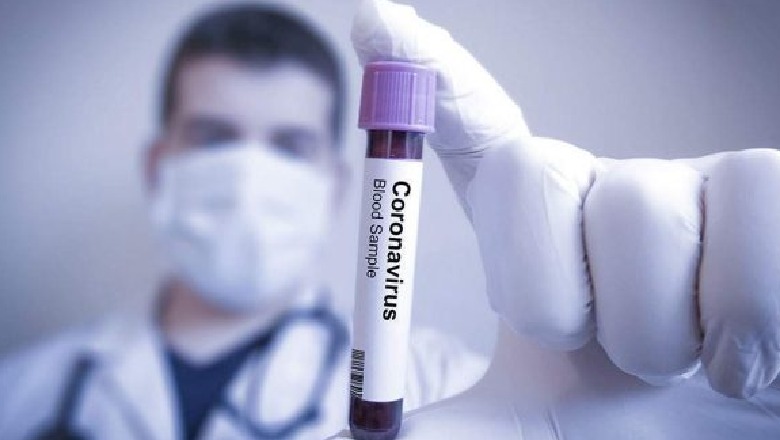 Koronavirusi në botë, në Europë kanë humbur jetën 75 mijë persona, rriten shifrat në Amerikë 20 mijë të vdekur