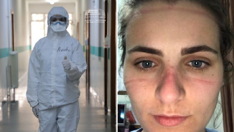 'Shembull i përkushtimit dhe sakrificës për profesionin', Manastirliu publikon foton e mjekes shqiptare me shenjat e maskës