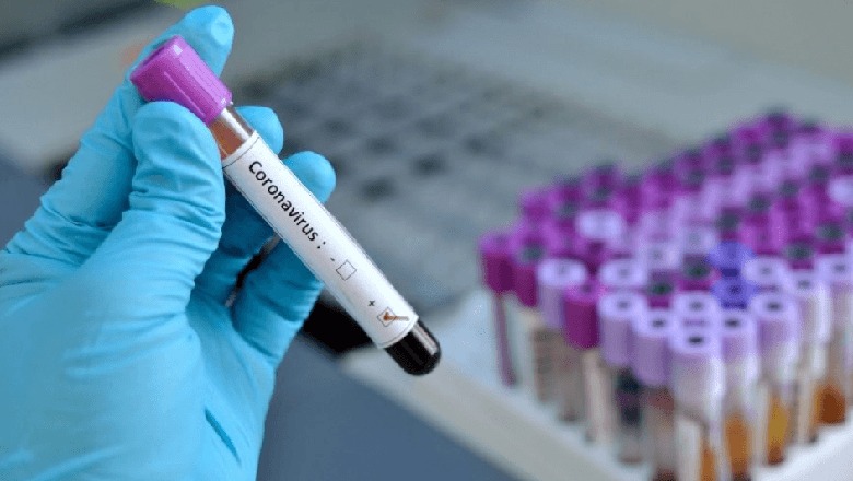 Britania fillon testet ndaj njerëzve për një vaksinë kundër COVID-19/ 500 persona pjesë e projektit të Oksford, vullnetarja tregon rreziqet e nismës