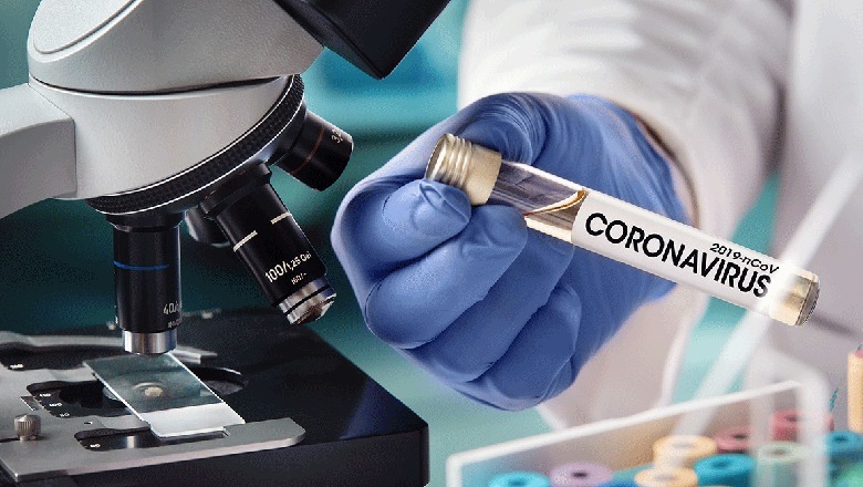 Covid-Kompania farmaceutike amerikane nis testimin në njerëz të terapisë me antitrupa