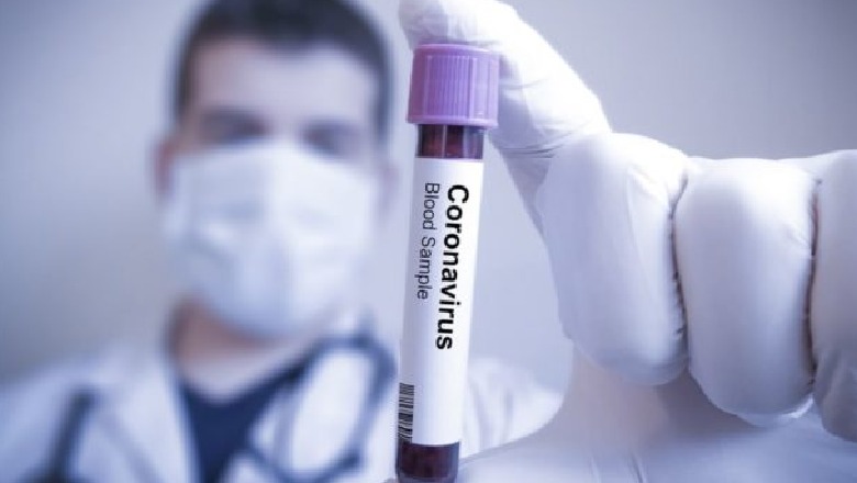 Covid/ Medikamenti i ri rus, vret 77,5% të virusit në 5 ditët e para