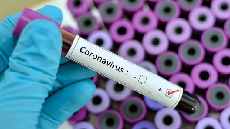 Bumerangu i antitrupave Covid…Ata që ri-infektohen kanë formë më të rëndë të sëmundjes