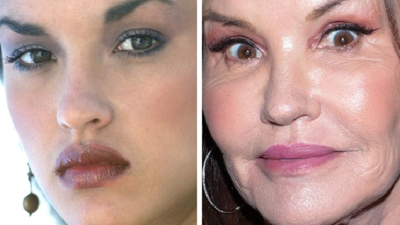 10 fotografi që tregojnë se si kanë ndryshuar fytyrat e modeleve të njohura me kalimin e kohës