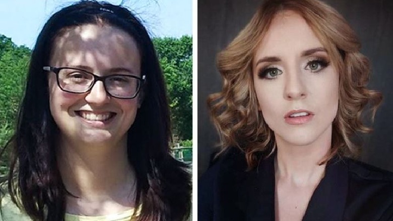 10 njerëz që ndryshuan pamjen e tyre të jashtme dhe zbuluan një 'person' të ri 