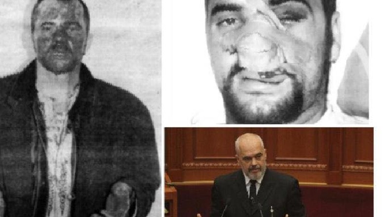 Hamdi Jupe: 25 vjet më parë, kush e rrahu Kryeministrin?