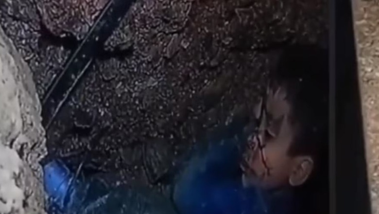 Katër ditë nëntokë, 5-vjeçari maroken gjendet i vdekur! Momenti kur ekipi i shpëtimit nxjerr Rayan-in nga pusi (VIDEO)