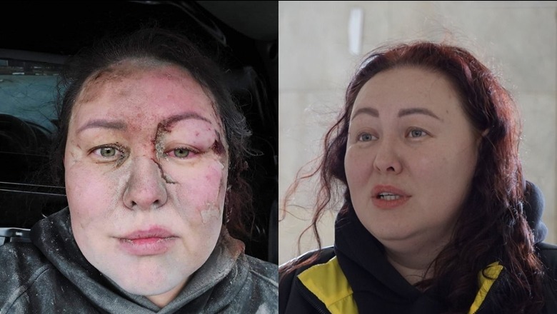 Ayuna Mozorova, e mbijetuara e disa sulmeve ruse në Kharkiv 