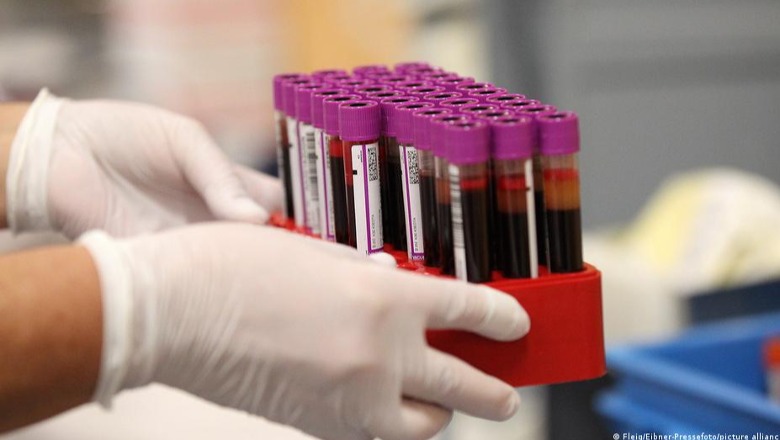 Një testi i ri gjaku zbulon mbi 50 lloje kanceri