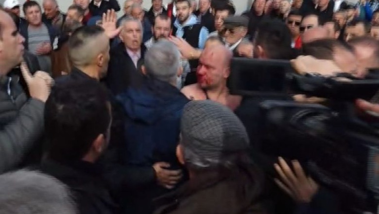 FOTOLAJM/ Goditi me grusht Berishën, dhunuesi i gjakosur pasi e rrahën protestuesit