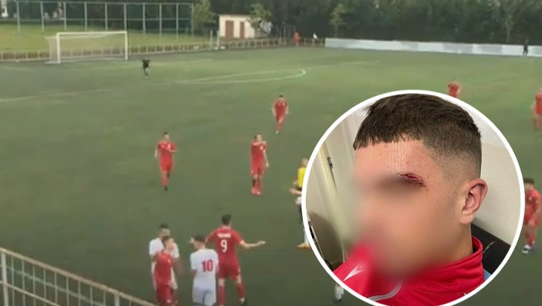 VIDEO/ Dhunë në futbollin e moshave, tifozët godasin futbollistët e Akademisë Skënderbeut! Reagon klubi: U rrezikua jeta e 17-vjeçarëve