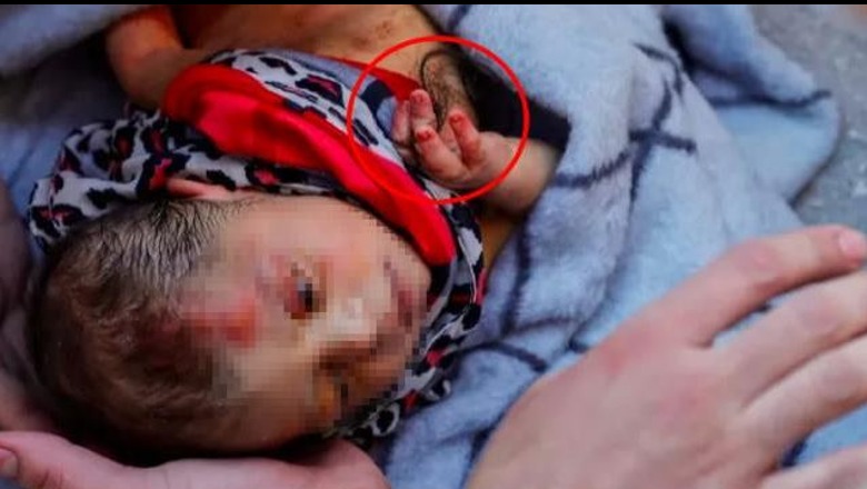 Nxirret e gjallë nga rrënojat pas 60 orësh foshnja 20-ditëshe në Turqi, në duar kishte flokët e nënës së saj (VIDEO)