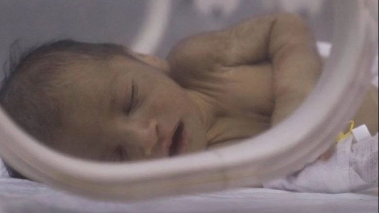 Nëna dhe foshnja shpëtohen dy herë në tre ditë nga tërmeti në Siri