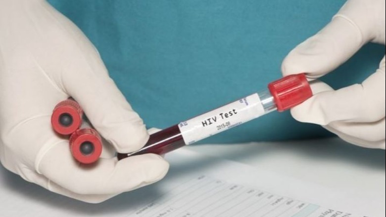 I treti që arrin të fitojë betejën, ‘Pacienti i Dyseldorfit’ në Gjermani shërohet nga HIV