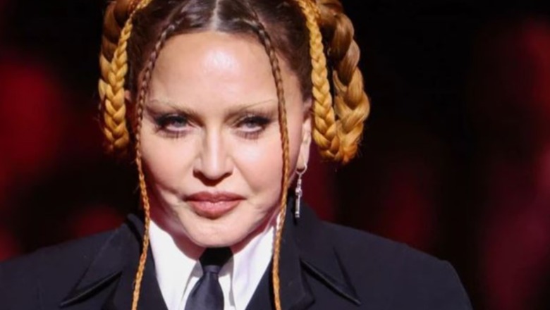 'Mbretëresha e pop-it' Madonna pranon se ka bërë operacione plastike, ja cila është aryeja