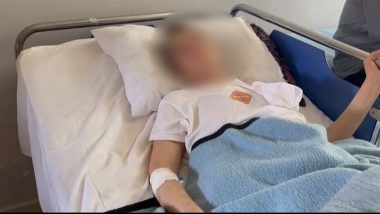 Bashkëshorti e hodhi nga shkallët, 55-vjeçarja në Korçë përfundon në spital me këmbë të thyer