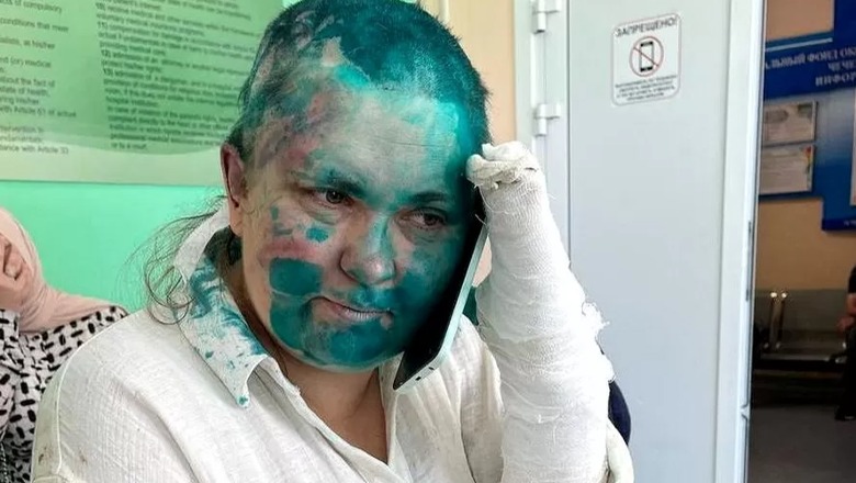 Çeçeni/ Persona të armatosur dhunojnë brutalisht gazetaren ruse dhe avokatin e saj! Ia rruajnë kokën, presin gishtat e i shëmtojnë fytyrën