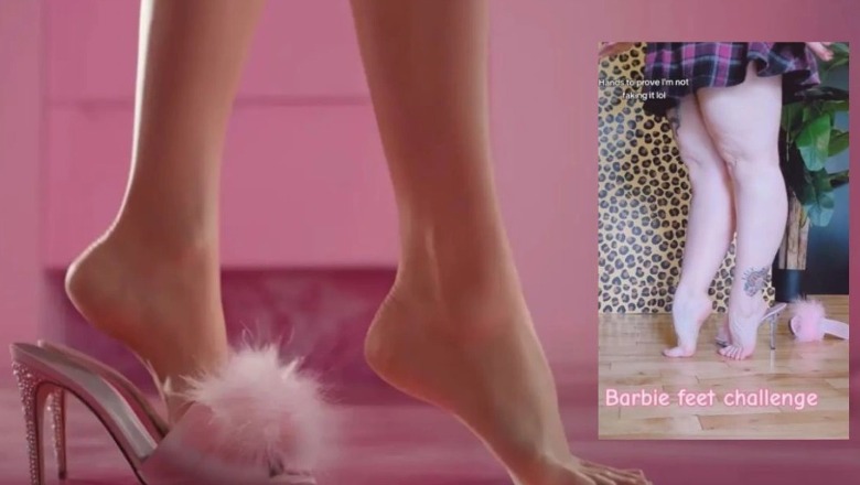 Me këmbën e lakuar dhe në majë të gishtave, sfida e ecjes Barbie ‘bën namin’ në TikTok! Ortopedët paralajmërojnë për lëndime