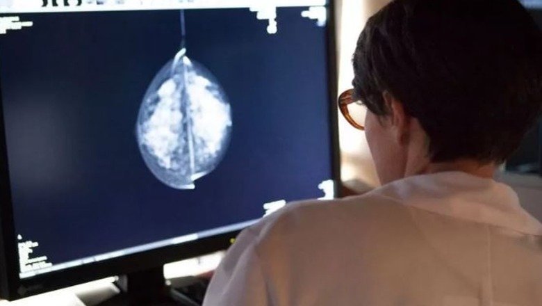 Studimi i ri: Inteligjenca artificiale ekzaminuesi më korrekt i kancerit të gjirit
