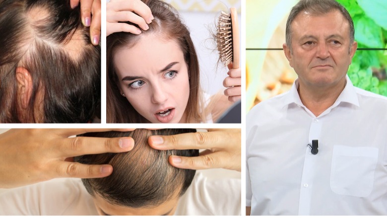 Ju bien flokët masivisht? Zbuloni shkaktarët dhe produktet bimore që ju vijnë në ndihmë / Ylli Merja tregon kurën disa javore për mbirjen e flokëve në mënyrë natyrale 