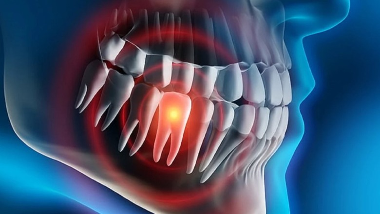 Nëntë mënyra si të trajtoni dhimbjen e dhëmbit gjatë natës
