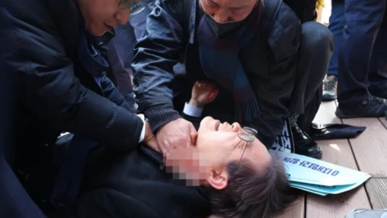 VIDEO+FOTO/ Qëllohet me thikë në qafë lideri i opozitës në Korenë e Jugut 