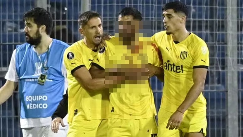 VIDEO/ E frikshme në Argjentinë, lojtari dhunohet në fushë dhe kalon natën në spital