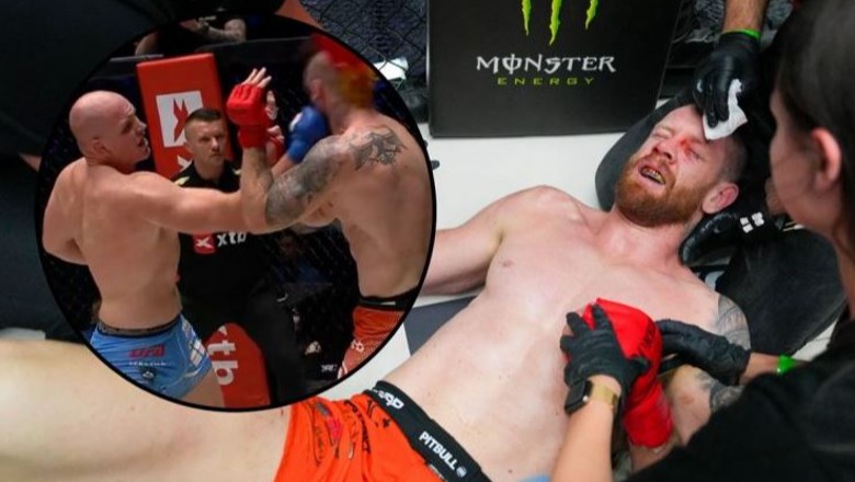 VIDEO/ Grushti fatal e plas në tokë, ish-portieri i Chelsea humbje të dhimbshme në MMA
