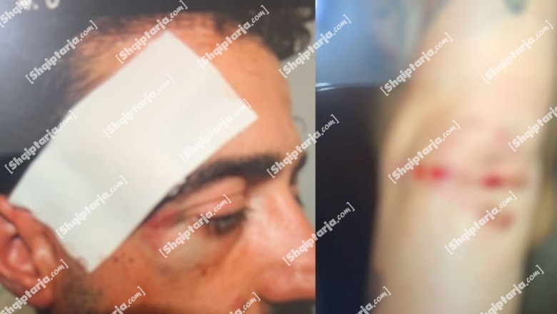 Dhunuan me grushte një person në spital, Gjykata e Durrësit cakton masën 'arrest në burg' për tre familjarët e të dashurës së 32-vjeçarit