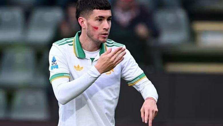 Roma me hap kampioni  mposht 1 3 Cremonesen dhe merr kreun e Serie A