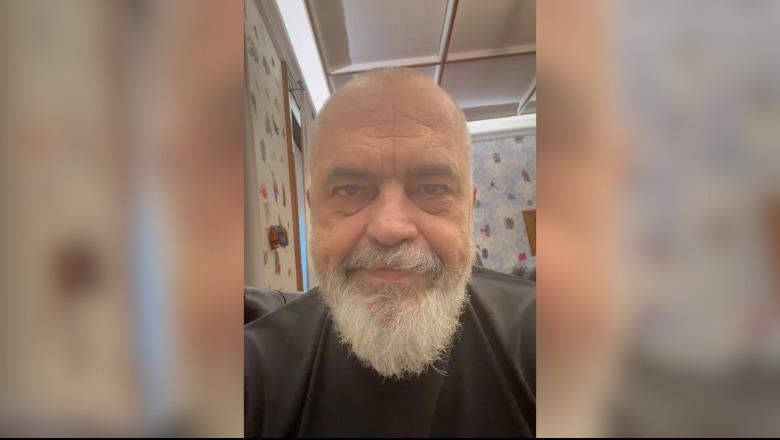 Pse s'e shkarkon Ballukun? Rama: Do krijonte problem për të nesërmen, 'miu' i zhbalancimit të pushteteve do kthehej në 'ujk' kundër qeverisë (VIDEO)