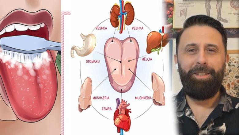 Gjuha ‘harta’ e organizmit tonë! Ngjyra dhe forma e saj paralajmëron sëmundje, nga mëlçia tek zemra e stomaku…