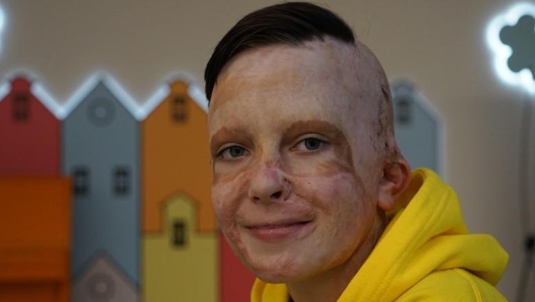 Raketat ruse i vranë nënën në spital! Rrëfimi i 11 vjeçarit ukrainas përlot sallën në Parlamentin Europian