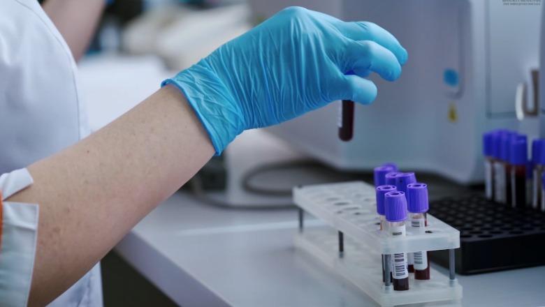 Teknologji moderne në Qendrën Kombëtare të Transfuzionit të Gjakut, dhurimet vullnetare rriten me 12%