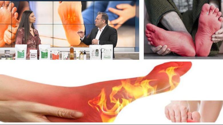 Këmbë që djegin, mpihen apo shpojnë, ja çfarë paralajmërojnë për trupin tuaj! Njihuni me shkaqet dhe metodat si mund t’i kuroni