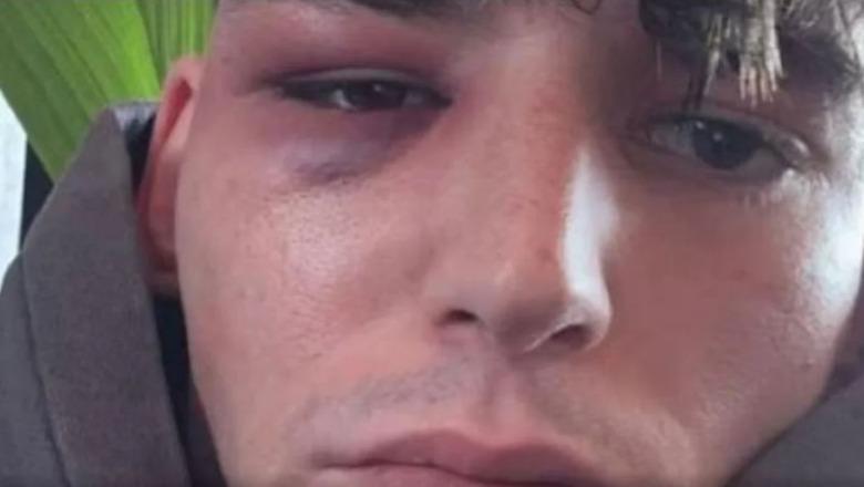 Propozoi të dashurin për martesë para 50 mijë tifozëve të Këlnit, dhunohet në shtëpi arbitri gjerman