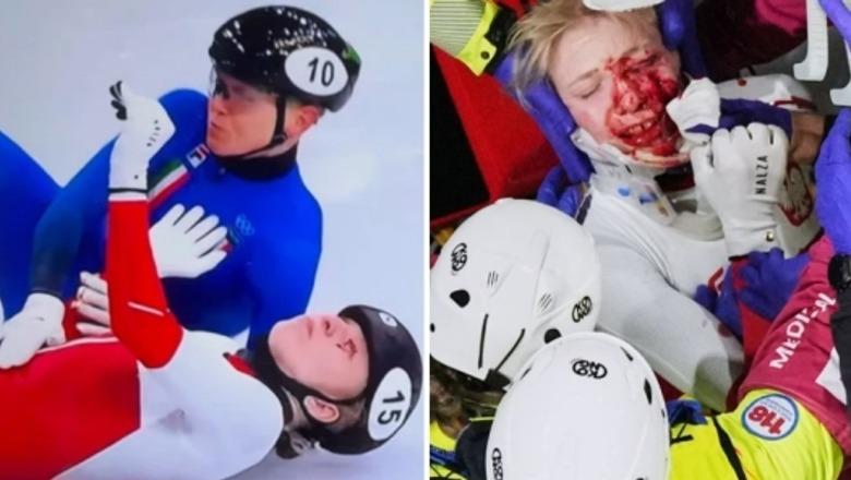 'Milano Cortina'/ Prag tragjedie në Olimpiadë, gjakoset sportistja polake e patinazhit! Tehu i rrezikoi syrin e majtë (VIDEO)