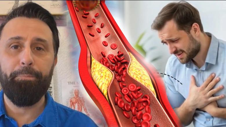 Kolesteroli, e VËRTETA që nuk ta kanë thënë / Këshilla nga Altin Joka