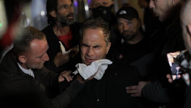 Protesta e Berishës, 4 të lënduar transportohen te ‘Trauma’! Mes tyre 1 efektiv policie, Luçiano Boçi dhe Kalaja