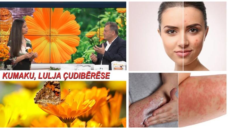 Kumaku ILAÇI natyral që habit me rezultatet në lëkurë! / Shëron brenda dhe jashtë
