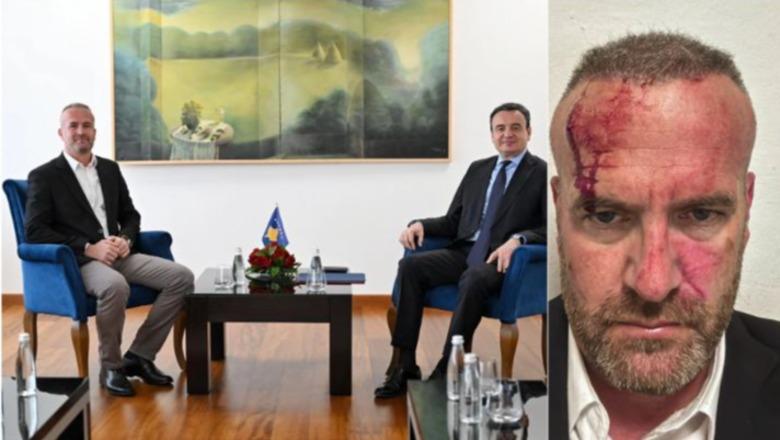Kreu i Vetëvendosjes në Skënderaj të Kosovës, akuzon kryetarin e komunës për dhunë : Policia të mbrojë familjen time! Vetëvendosja publikon foton e përgjakur