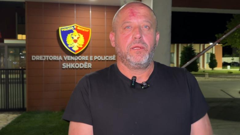 Dhunohet gazetari Ervin Dushi në Shkodër: Më rrahën brutalisht pronari i rrjetit të marketeve ‘Xhedis’ dhe 2 persona të tjerë, shkak denoncimi për kërcënimin e një qytetari