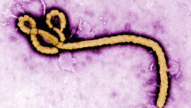 Ishte kthyer nga Kongo, identifikohet një rast i dyshuar me Ebola në Cagliari! Pacienti u nënshtrohet analizave dhe izolimit