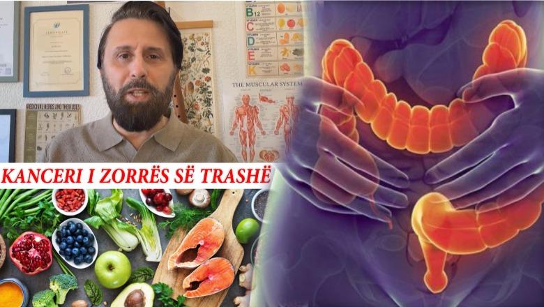 20-vjeçarë me kancer në zorrën e trashë, nutricionisti ngre shqetësimin: Dalloni këto shenja dhe mos hani këto produkte!